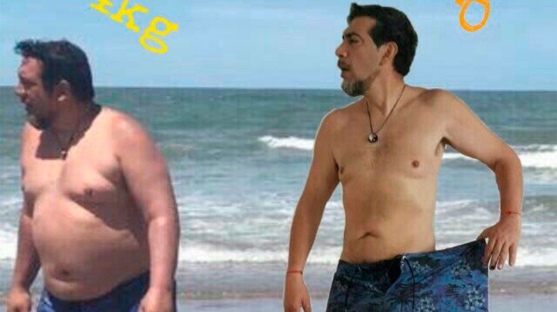 El antes y el después de Pato Galván