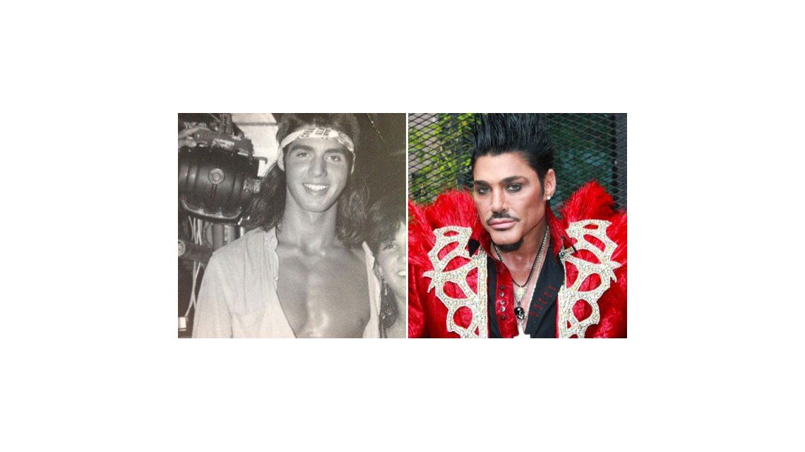 El antes y el después de Ricardo Fort