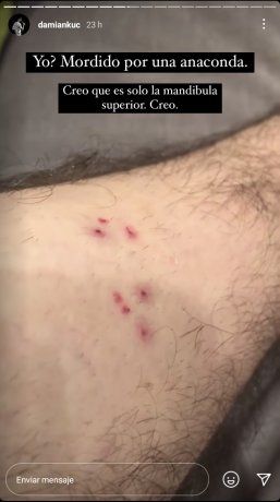 ¡Un dia tranqui! El youtuber Damián Kuc fue atacado por una anaconda