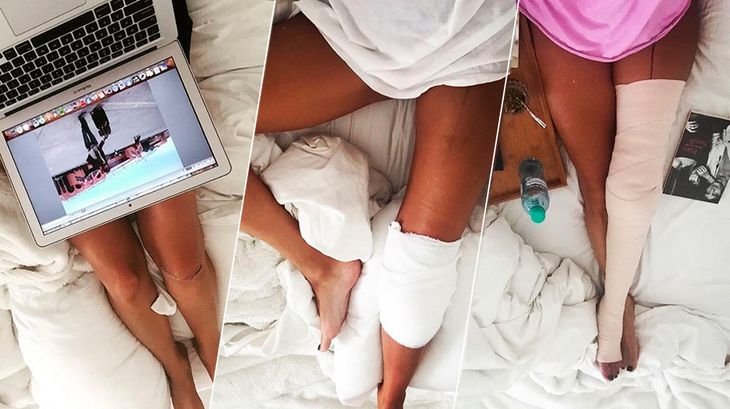 Entre algodones: recién operada y en reposo, Isabel Macedo mostró sus piernas sexies